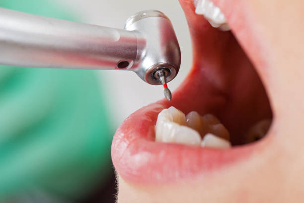 Best Broken or Cracked Tooth Emergency Dentist in Thompson, ND